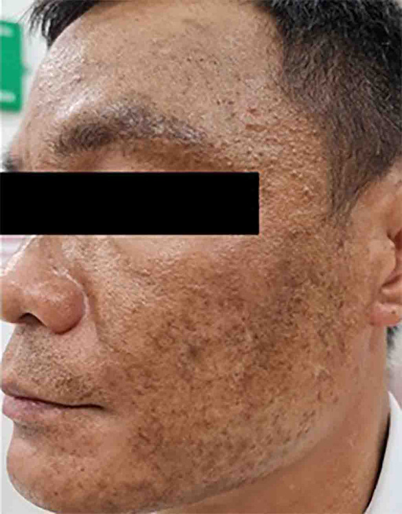 Tia cực tím mức nguy hại rất cao sẽ gây ra nguy cơ gì? Tia cực tím mức nguy hại rất cao sẽ gây ra nguy cơ gì? - Ảnh 2.